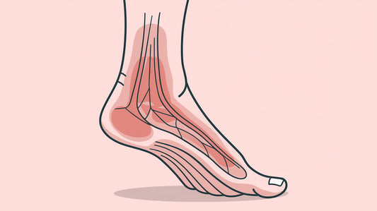 Diagram of a human foot with the plantar fascia highlighted in the arch and heel areas, which are common sites of plantar fasciitis pain.